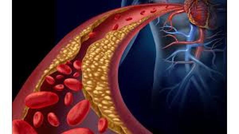 هل ارتفاع الكوليسترول يسبب ألم العظام