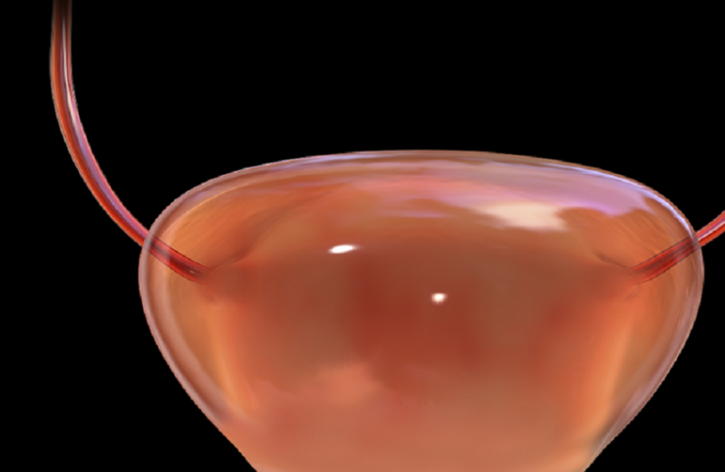 طبيبة روسية تكشف بعض الأخطاء في علاج التهاب المثانة